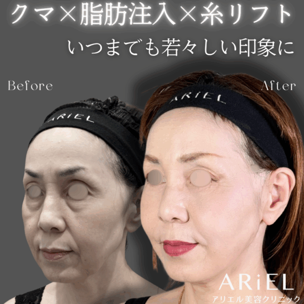 No.9138の症例写真